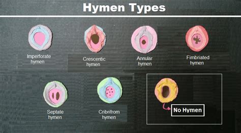 Hymen